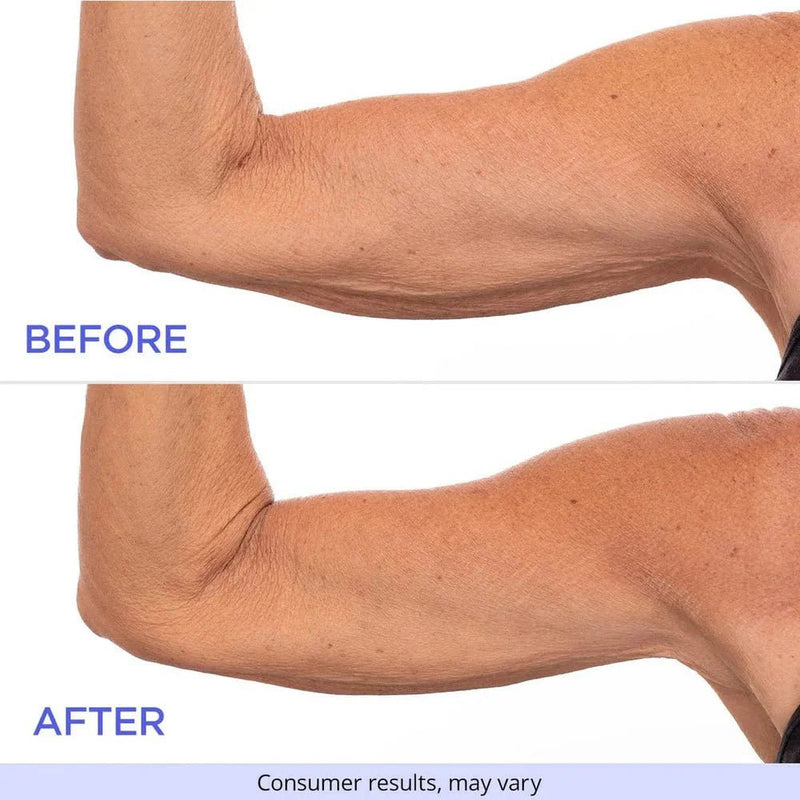 SculptSkin™ - Voor een Stevige, Gladde Huid Zonder Gedoe - Azora